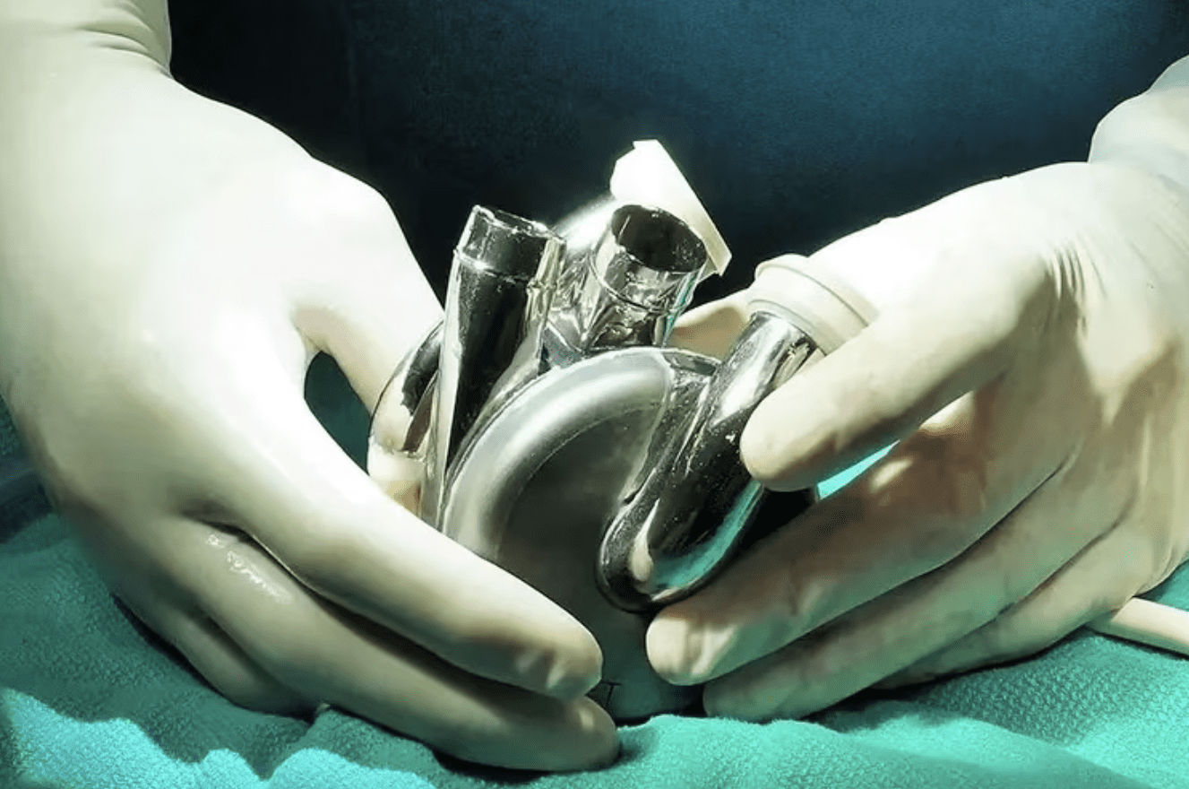 Surgeon wearing disposable gloves holds BiVACOR Artificial Heart